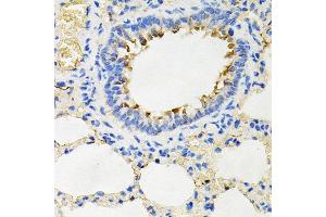 Immunohistochemistry of paraffin-embedded rat lung using IRAK2 antibody at dilution of 1:100 (x40 lens).