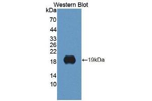 Figure. (BPGM antibody  (AA 85-216))