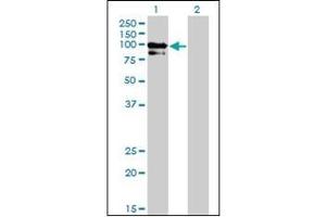 Western Blotting (WB) image for anti-Oculocerebrorenal Syndrome of Lowe (OCRL) (AA 146-240) antibody (ABIN782420) (OCRL antibody  (AA 146-240))
