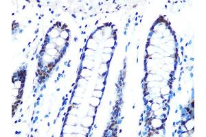 Immunohistochemistry of paraffin-embedded human colon using DYNLL1 Rabbit mAb (ABIN7266864) at dilution of 1:100 (40x lens). (DYNLL1 antibody)