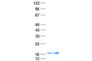 Validation with Western Blot (C1orf61 Protein (His tag))