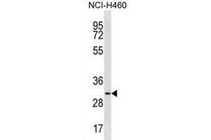TMIGD2 Antibody (Center) (ABIN1881890 and ABIN2839020) western blot analysis in NCI- cell line lysates (35 μg/lane). (TMIGD2 antibody  (AA 119-147))