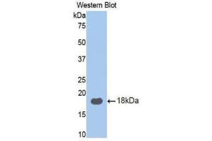 Western Blotting (WB) image for anti-Ribophorin 1 (RPN1) (AA 180-307) antibody (ABIN1860467) (RPN1 antibody  (AA 180-307))