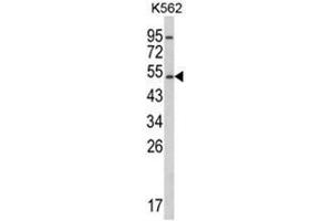 Western blot analysis of CYP2E1 Antibody (C-term) in K562 cell line lysates (35ug/lane).