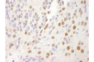 anti-Nuclear Receptor Binding Factor 2 (NRBF2) (AA 125-175) antibody