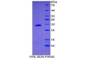SDS-PAGE analysis of Human Dermatopontin Protein. (Dermatopontin Protein (DPT))