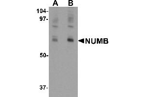 Western blot analysis of NUMB in mouse lung tissue lysate with NUMB antibody at (A) 0. (NUMB antibody  (C-Term))