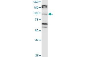 CDH11 monoclonal antibody (M05), clone 3C8. (OB Cadherin antibody  (AA 54-612))