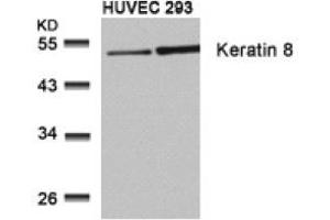 Image no. 3 for anti-Keratin 8 (KRT8) (Ser73) antibody (ABIN197583) (KRT8 antibody  (Ser73))