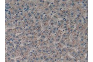 IHC-P analysis of Human Liver Tissue, with DAB staining. (DDR1 antibody  (AA 568-829))