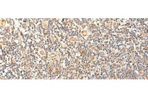 Immunohistochemistry of paraffin-embedded Human tonsil tissue using GPD1L Polyclonal Antibody at dilution of 1:60(x200) (GPD1L antibody)