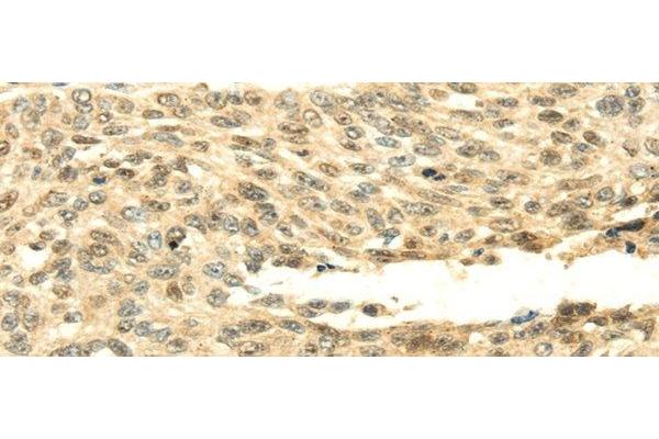 SHPRH antibody