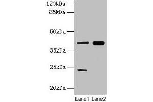 Western blot All lanes: MAP2K3 antibody at 10 μg/mL Lane 1: RAW264. (MAP2K3 antibody  (AA 1-347))