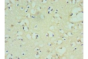 Immunohistochemistry of paraffin-embedded human brain tissue using ABIN7172637 at dilution of 1:100 (SOX6 antibody  (AA 1-74))