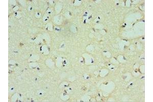 Immunohistochemistry of paraffin-embedded human brain tissue using ABIN7172637 at dilution of 1:100