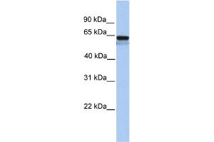 WB Suggested Anti-LCK Antibody Titration: 0. (LCK antibody  (N-Term))