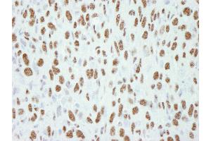 Immunohistochemistry (IHC) image for anti-Transcription Elongation Regulator 1 (TCERG1) (AA 1-50) antibody (ABIN7448453) (TCERG1 antibody  (AA 1-50))