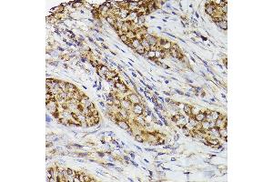 Immunohistochemistry (IHC) image for anti-Prostaglandin-Endoperoxide Synthase 2 (Prostaglandin G/H Synthase and Cyclooxygenase) (PTGS2) (AA 375-604) antibody (ABIN6146415)