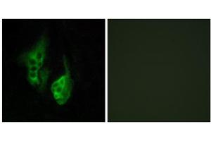 Immunofluorescence analysis of HeLa cells, using OPN5 antibody. (OPN5 antibody  (C-Term))