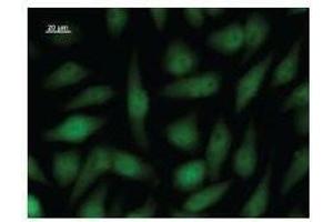 Immunostaining analysis in HeLa cells. (HIRA antibody)