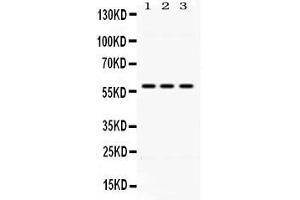 Western blot analysis of ALDH7A1 expression in rat liver extract ( Lane 1), HEPA whole cell lysates ( Lane 2) and HELA whole cell lysates ( Lane 3). (ALDH7A1 antibody  (C-Term))