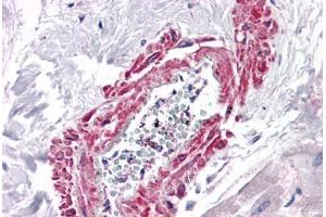 Human Heart, Vessel: Formalin-Fixed, Paraffin-Embedded (FFPE) (Angiotensin II Type-1 Receptor antibody  (AA 201-250))