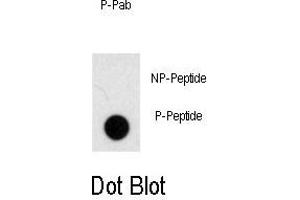 Dot blot analysis of anti-Phospho-NOMO1-p Antibody (ABIN389948 and ABIN2839757) on nitrocellulose membrane. (NOMO1 antibody  (pSer1205))