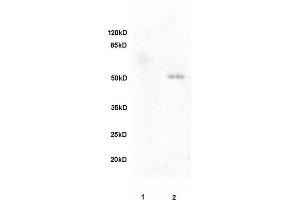 L1 rat brain, L2 human colon carcinoma lysates probed (ABIN728473) at 1:200 in 4 °C. (Fibulin 5 antibody  (AA 101-200))