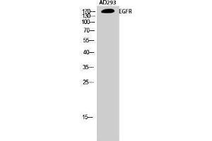Western Blotting (WB) image for anti-Epidermal Growth Factor Receptor (EGFR) (Ser315) antibody (ABIN3184422) (EGFR antibody  (Ser315))