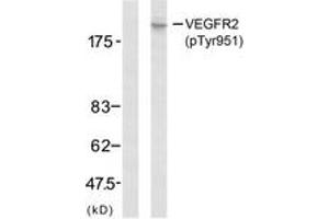 Western Blotting (WB) image for anti-VEGF Receptor 2 (VEGFR2) (pTyr951) antibody (ABIN2888557) (VEGFR2/CD309 antibody  (pTyr951))