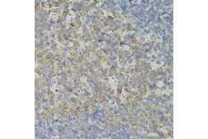 Immunohistochemistry of paraffin-embedded mouse spleen using IRF1 antibody. (IRF1 antibody)