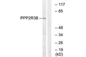 Western blot analysis of extracts from K562 cells, using PPP2R3B Antibody. (PPP2R3B antibody  (AA 364-413))
