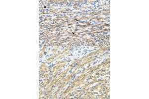 Immunohistochemical staining (Formalin-fixed paraffin-embedded sections) of (A) and (B) human heart with MBNL1 polyclonal antibody .