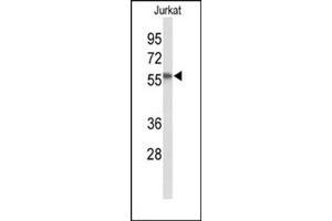 Western blot analysis in Jurkat cell line lysates (35 ug/lane) using SACM1L Antibody (C-term) Cat.