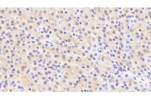 Detection of ACY1 in Human Liver Tissue using Polyclonal Antibody to Aminoacylase 1 (ACY1) (Aminoacylase 1 antibody  (AA 2-408))
