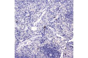 IHC testing of FFPE rat spleen tissue with HE4 antibody at 0. (WFDC2 antibody  (AA 31-124))