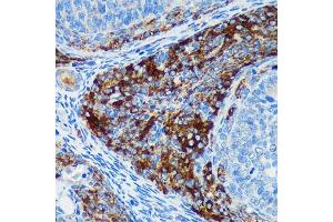 Immunohistochemistry of paraffin-embedded Rat ovary using PIGU Rabbit pAb (ABIN7269291) at dilution of 1:100 (40x lens). (PIGU antibody)