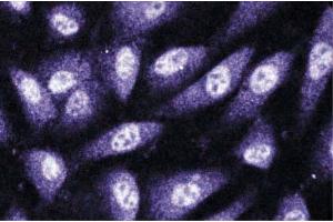 Immunofluorescence staining of human endothelial cells. (CNKSR1 antibody  (AA 10-217))
