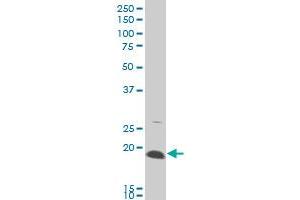 AMELX monoclonal antibody (M03), clone 3B5 Western Blot analysis of AMELX expression in A-431 . (AMELX antibody  (AA 93-191))