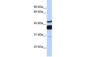 WB Suggested Anti-LASS2 Antibody Titration:  0. (Ceramide Synthase 2 antibody  (N-Term))