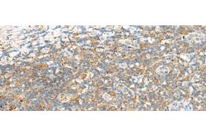 Immunohistochemistry of paraffin-embedded Human tonsil tissue using TTLL1 Polyclonal Antibody at dilution of 1:60(x200)