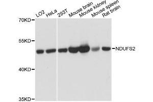 Western blot analysis of extracts of various cell lines, using NDUFS2 antibody.