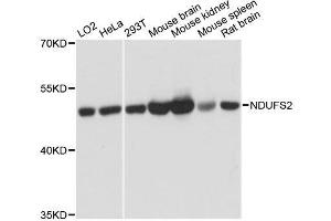 Western blot analysis of extracts of various cell lines, using NDUFS2 antibody. (NDUFS2 antibody  (AA 204-463))