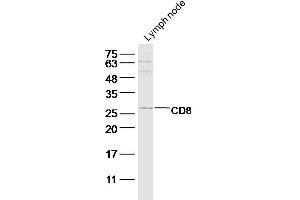 Mouse lymph node lysate probed with CD8a Polyclonal Antibody at 1:300 overnight in 4˚C. (CD8 antibody  (AA 101-200))