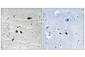 Immunohistochemistry (IHC) image for anti-Mdc1 (MDC1) (pSer513) antibody (ABIN1847791) (MDC1 antibody  (pSer513))