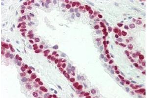 Human Prostate: Formalin-Fixed, Paraffin-Embedded (FFPE) (HMGN1 antibody  (C-Term))