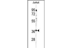 Western blot analysis of anti-PPP6C Antibody in Jurkat cell line lysates (35ug/lane). (PPP6C antibody  (C-Term))