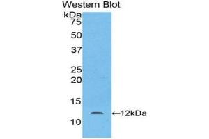 Detection of Recombinant LAMb2, Mouse using Polyclonal Antibody to Laminin Beta 2 (LAMb2) (LAMB2 antibody  (AA 1176-1309))