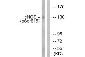Western blot analysis of extracts from K562 cells, treated with EGF (40nM, 30mins), using eNOS (Phospho-Ser615) antibody. (ENOS antibody  (pSer615))
