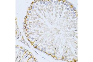 Immunohistochemistry of paraffin-embedded rat testis using PIKFYVE antibody (ABIN5974035) at dilution of 1/100 (40x lens). (PIKFYVE antibody)